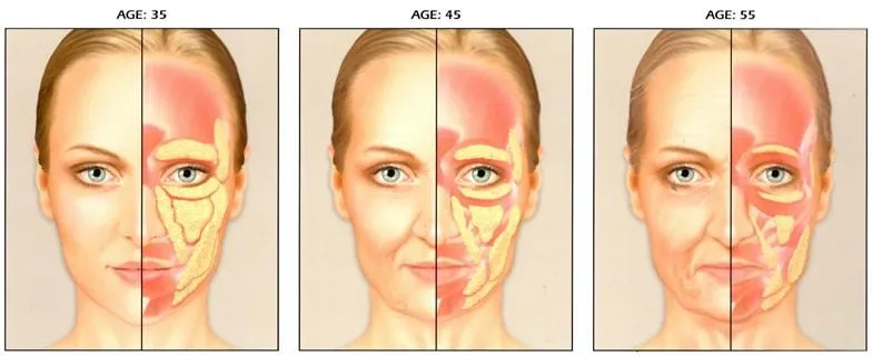 aging